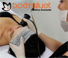 BODYSILUET - BODYSILUET OFRECE APARATOLOGÍA DE CALIDAD EN SUS FRANQUICIAS