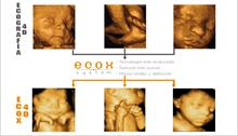 Ecox 4D - Ecox 4D crea un sistema que aumenta la nitidez y definición de las imágenes prenatales 