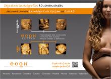 Ecox 4D crea un sistema que aumenta la nitidez y definición de las imágenes prenatales 